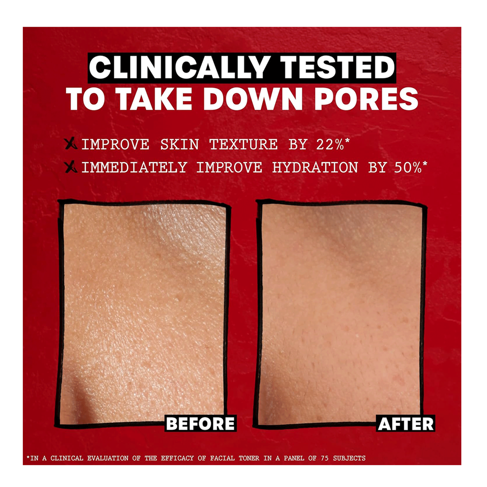 THAYERS Alcohol-Free Witch Hazel Toner (12oz)