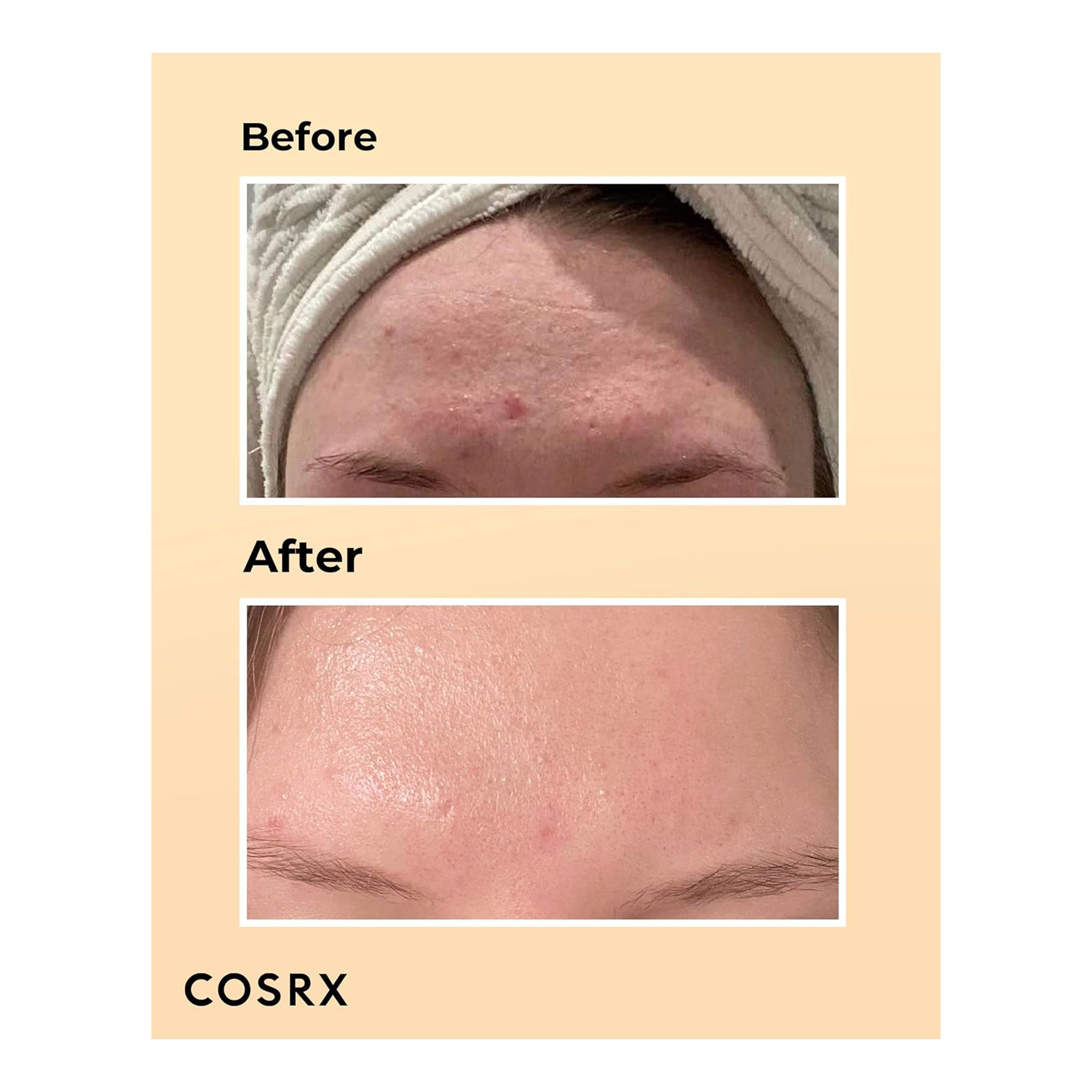 COSRX Advanced Snail 96 Mucin Power Essence (100ml)